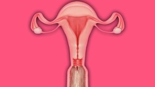 X-Ray tentacle penetration [Palefire34]