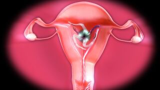 (X-ray) Tifa's perfect pussy filled by tentacle monster